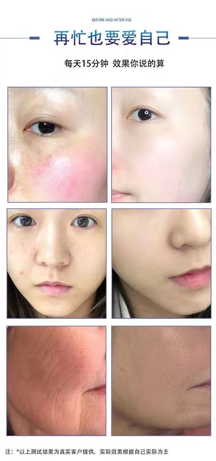 Led facial mask - Image 2